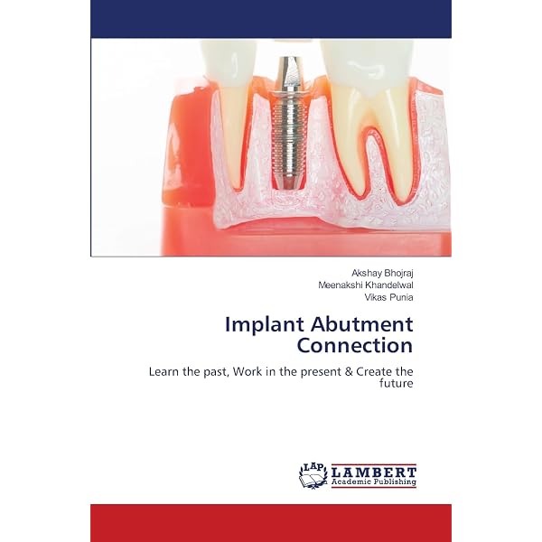 ITI Treatment Guide: Loading Protocols in Implant